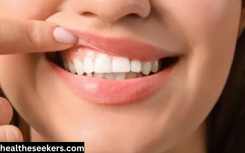 what is the best toothpaste for gum disease